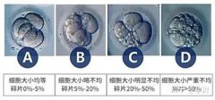 泰国试管婴儿-胚胎级别怎么看