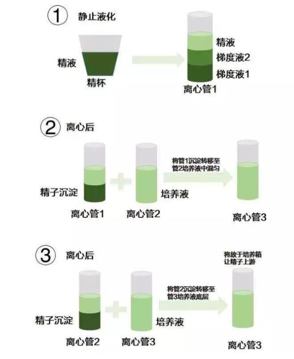 <a href='/tags/57_1.html' target='_blank'><u>HIV</u></a>洗精术具体流程