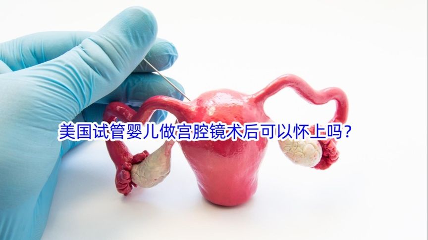 美国试管婴儿做宫腔镜术后可以怀上吗？